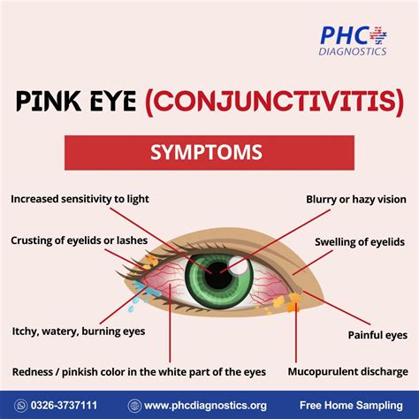 Pink Eye Conjunctivitis Phc Diagnostics Private Limited
