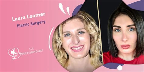 The Truth Behind Laura Loomer Plastic Surgery The Truth Behind Laura Loomer Plastic Surgery